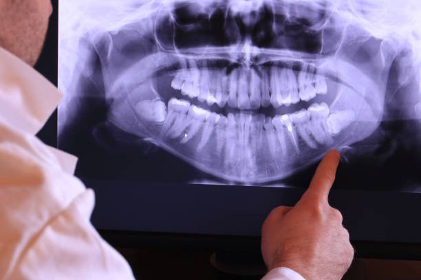 Best Weekend Emergency Dentist in Toulon, IL